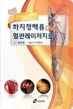 Điều trị giãn tĩnh mạch bằng laser